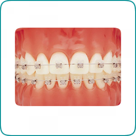 Cabinet stomatologic STOMSAN Dristor - servicii ortodontie 