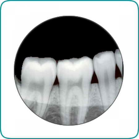Cabinet stomatologic STOMSAN Dristor - servicii radiologie dentara