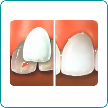 Cabinet stomatologic STOMSAN Dristor - servicii stomatologice de estetica dentara