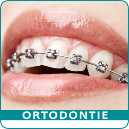 Pentru lucrari de ortodontie va asteptam la mediul nostru specialist de la STOMASAN Dristor